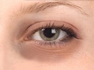 Many people suffer from dark eye bags and circles. Glow Skin White cream will make you look better in no time 