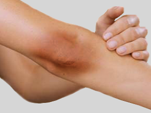 Unsightly dark knees and elbows can make you feel unattractive. Regain your confidence with GLOW skin whitening cream
